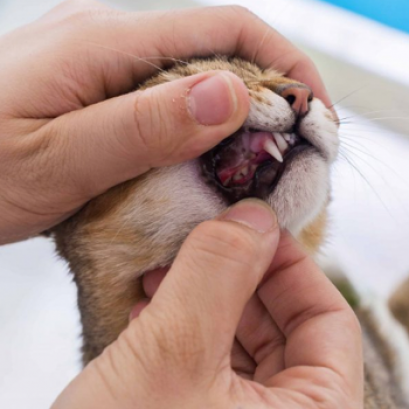 ขูดหินปูน (Dental Scaling Package)